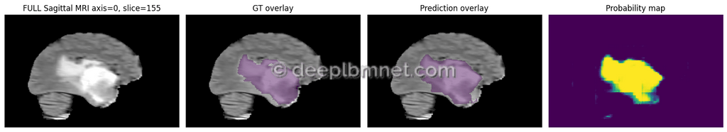 LBMNet is a new architecure for IMedical Imaging Segmentation base in the lattice Boltzmann Method