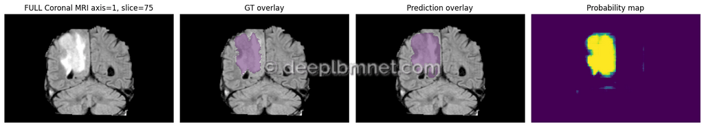 LBMNet is a new architecure for IMedical Imaging Segmentation base in the lattice Boltzmann Method