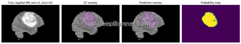 3D Medical Image Segmentation