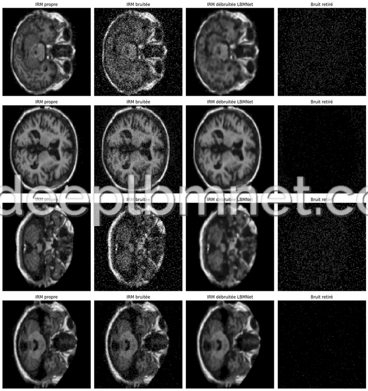 LBMNet is a new architecure for Medical MRI Image Denoising based in the lattice Boltzmann Method