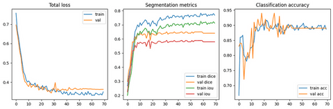 curve of learning for 3D Medical Image Segmentation